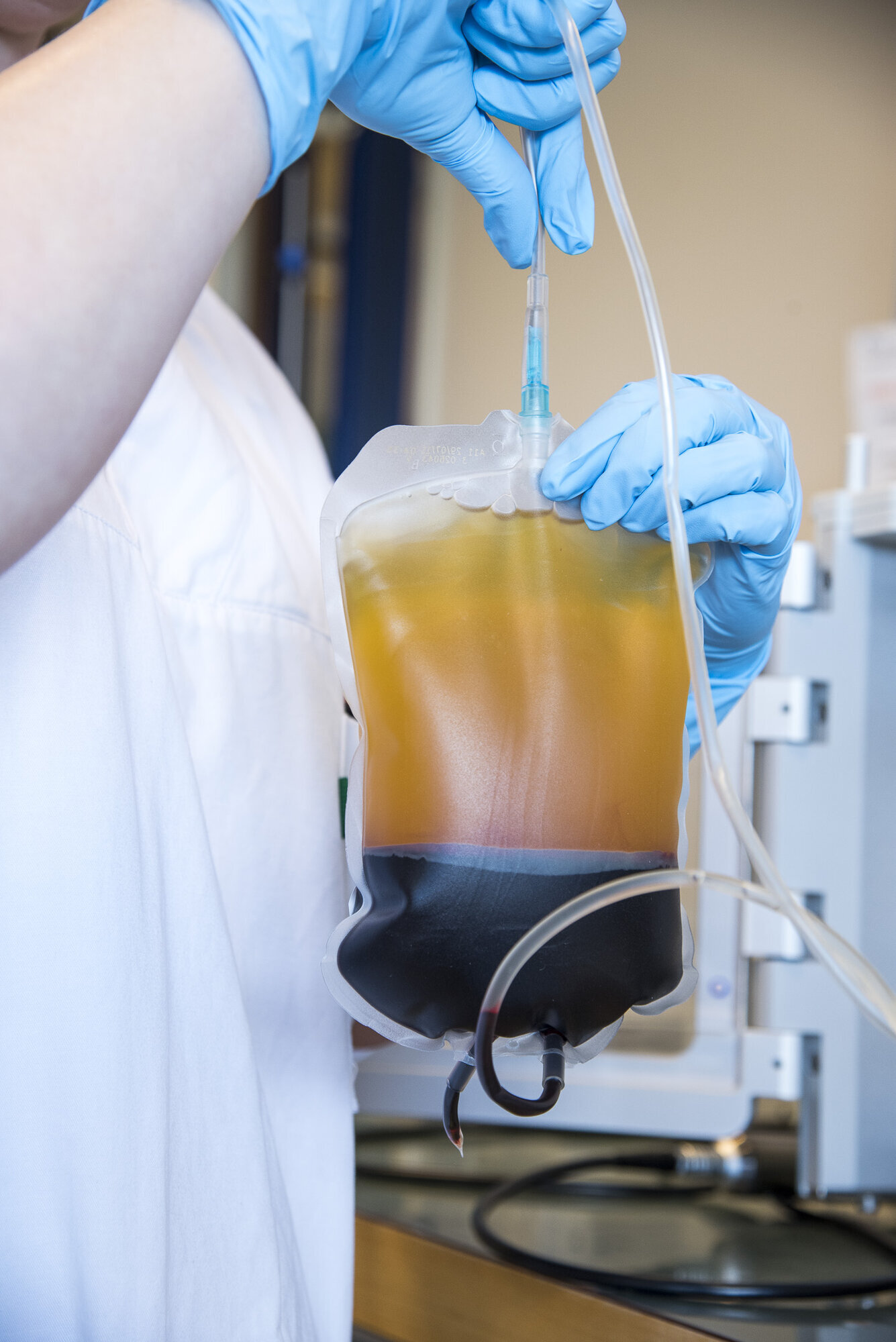 blod, sentrifugert Bildet viser en blodplate med gult plasma på toppen, gulhvit buffy coat i midten og erytrocytter nederst.