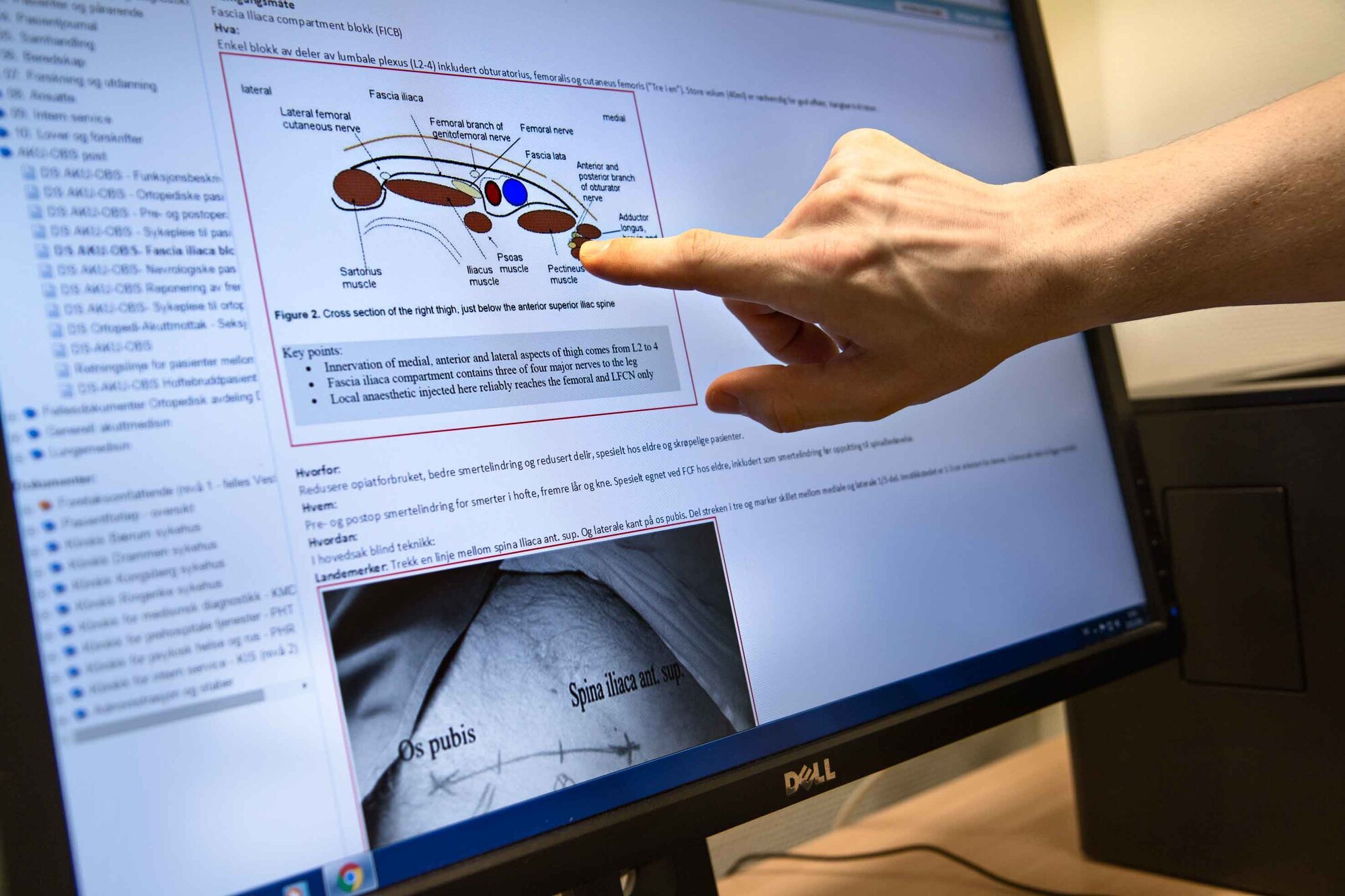 Hvordan sette blokade Hvordan sette blokade