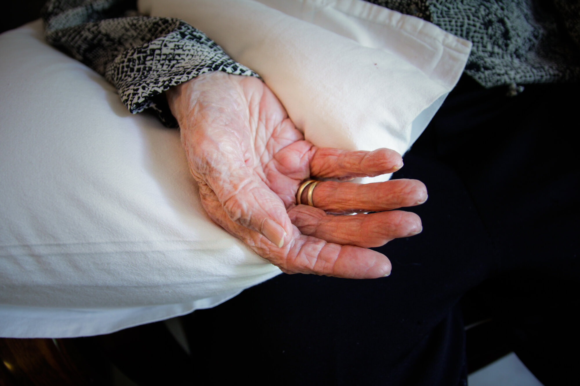 Pedersens hånd bildet viser hånden til Pedersen