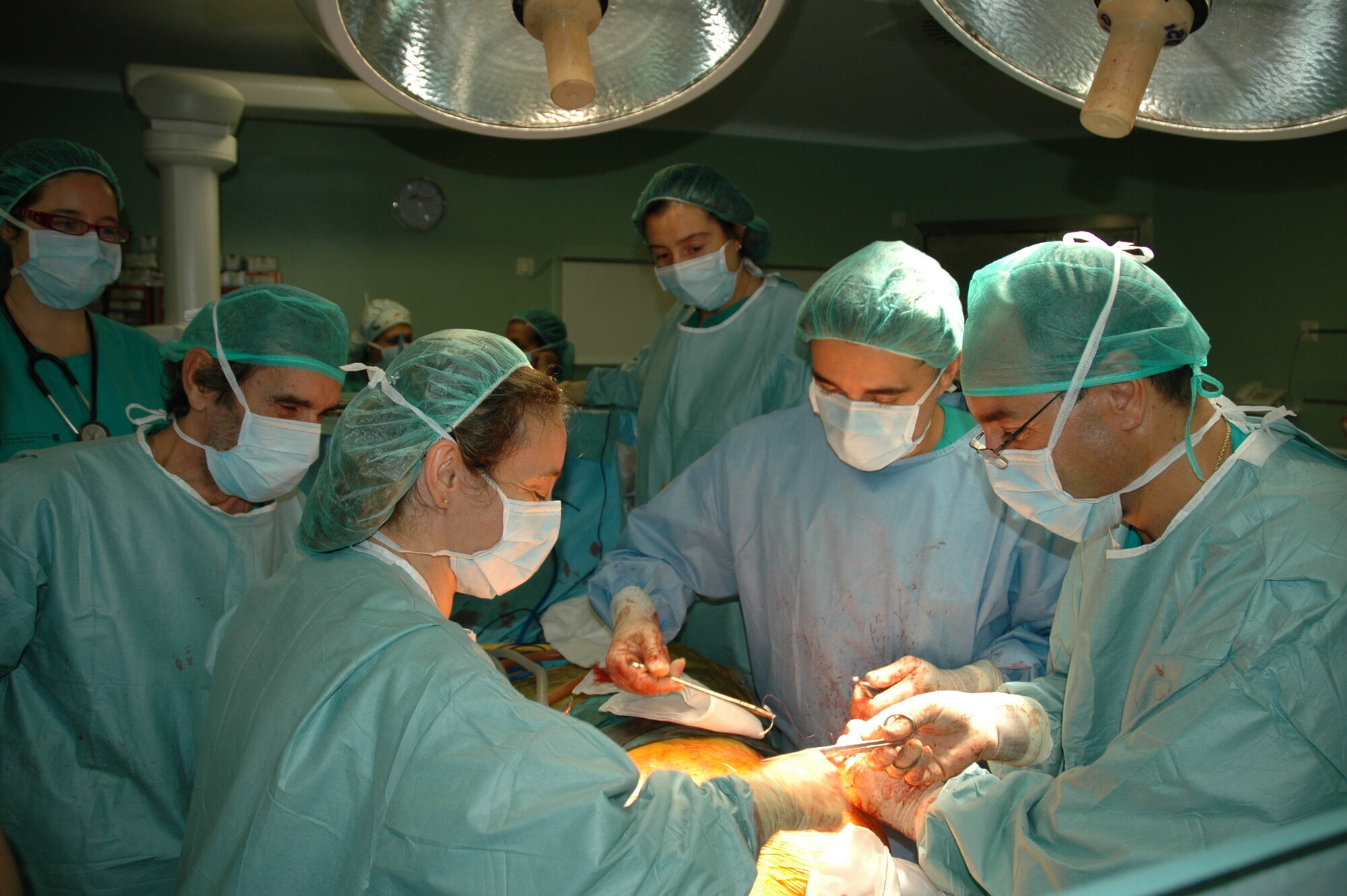 Lungetransplantasjon, Spania Bildet viser et kirurgisk team som utfører lungetransplantasjon.