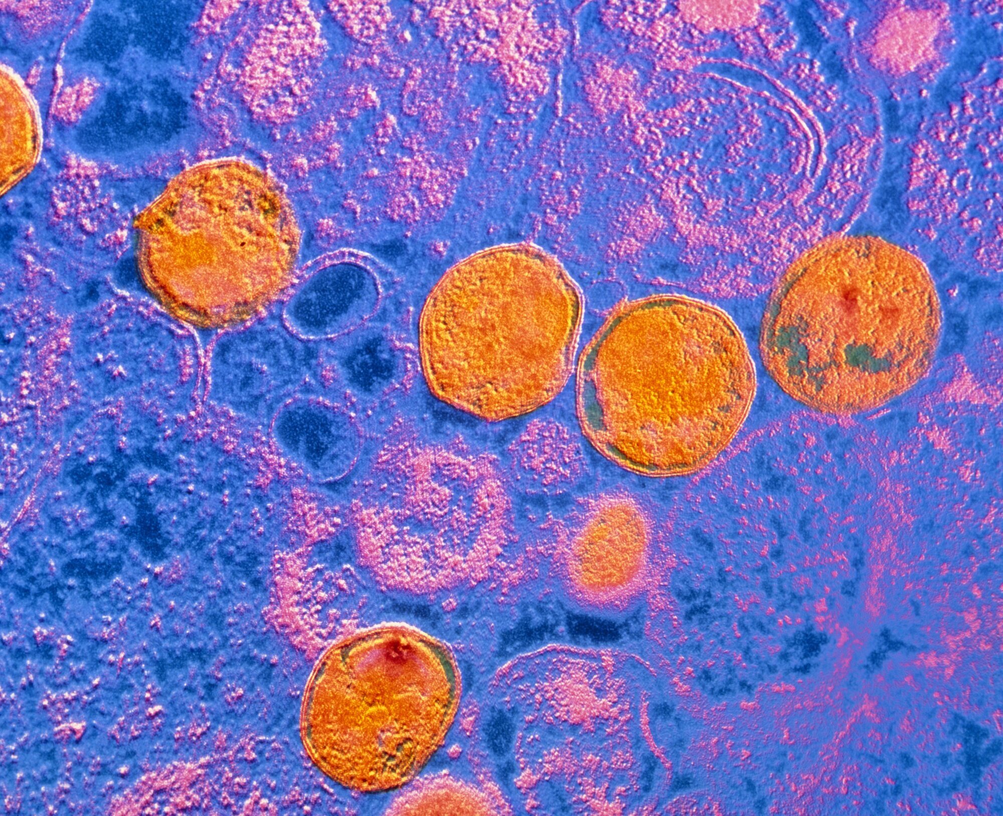 klamydia Bildet viser klamydia-bakterier.