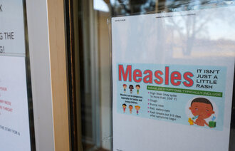 Bildet viser et skilt fra Texas som det står "meslinger" på.