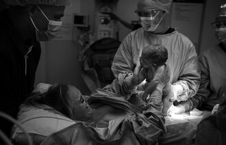 Bilde viser mor-asisterkeisersnitt