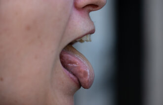 Bildet viser en kvinne som rekker tunge.