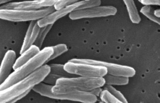 Et mikroskopbilde av tuberkulosebakterien fra 2006.