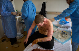 Bildet viser en mann med skader.